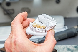 Hand holding model jaw containing dental bridge