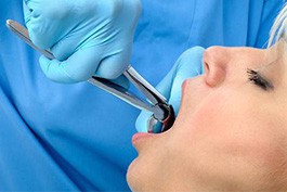 Female patient having tooth extracted