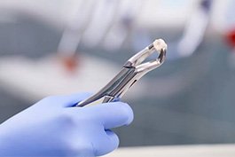 Metal tool holding an extracted tooth