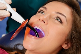 Dentist using curing light on female patient’s dental filling